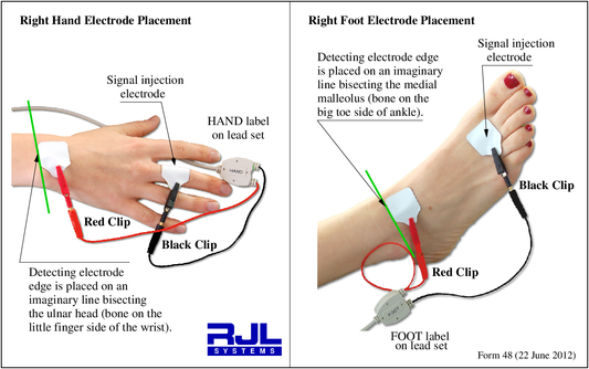 How Electrodes Are Placed on the Hand and Foot